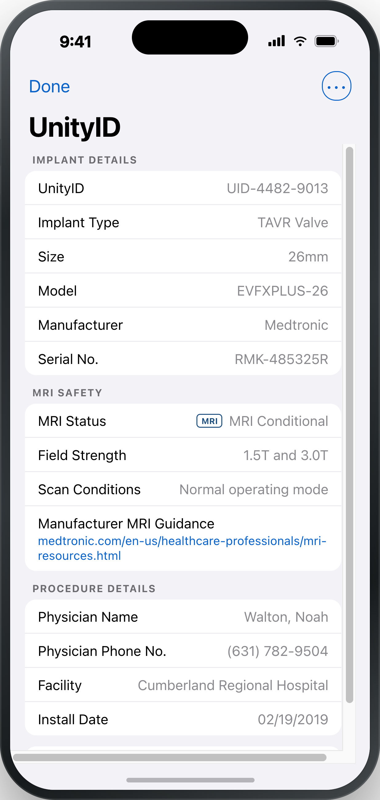 A phone showing the full UnityID record: implant model and serial number, MRI field-strength conditions, implanting physician, facility, and install date.